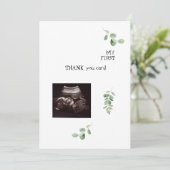 Ultrasound White Vielen Dank Baby Point-Ansicht Dankeskarte (Stehend Vorderseite)