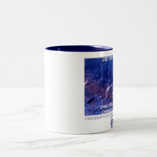 Universität der St- Thomasneurologie-Tasse Zweifarbige Tasse (Mittel)