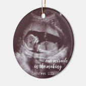 Unser Wunder, Ultraschallsonogramm-Foto zu machen Keramik Ornament (Links)