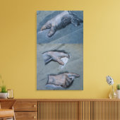 Untersuchung der Hände eines Mannes Leinwanddruck (Insitu (Wohnzimmer))