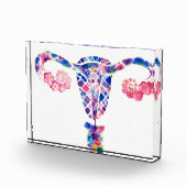 Uterus Fotoblock (Rechts)
