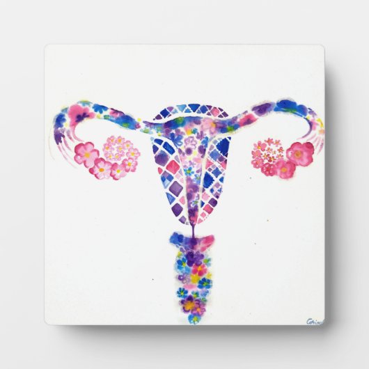 Uterus Fotoplatte (Vorderseite)