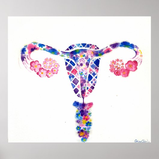 Uterus Poster (Vorne)