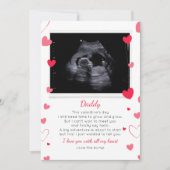 Valentine to Daddy from Bump (Vorderseite)