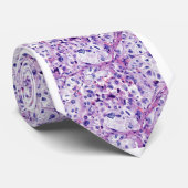 Valentinsgruß-pleomorphisches Sarkom Krawatte (Gerollt)