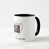 Valentinstag Ultrasound New Dad Tasse (VorderseiteRechts)