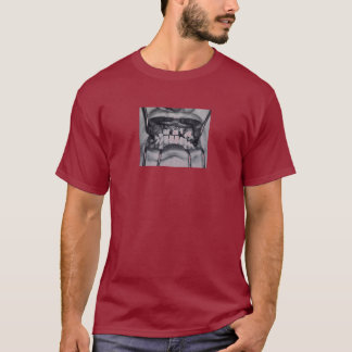 Verärgerte gebrochene Zähne T-Shirt