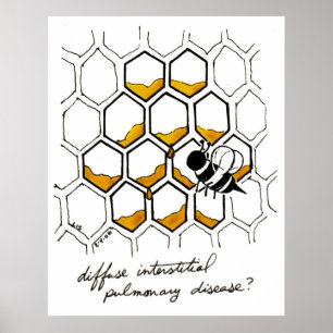 Verbreitete zwischenräumliche Lungenkrankheit Poster