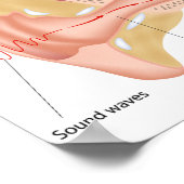 Verfahren für das Gehör-Poster Poster (Ecke)