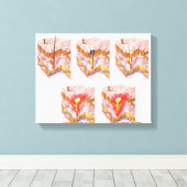 Verschiedene Arten von Akne Leinwanddruck (Insitu (Holzboden))