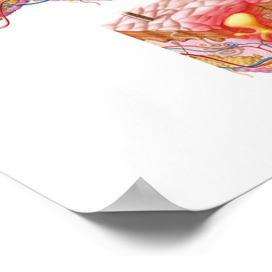 Verschiedene Arten von Akne Poster (Ecke)