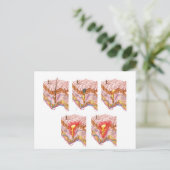 Verschiedene Arten von Akne Postkarte (Stehend Vorderseite)