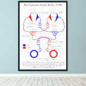 Vestibulo Ocular Reflex VOR Augenbewegung stabilis Leinwanddruck (Insitu (Holzboden))