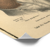 Vintag 1888 deutscher Anatomie Print Abdomen Poster (Ecke)