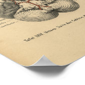 Vintag 1888 deutsches Anatomie-Druckgedächtnis Poster (Ecke)