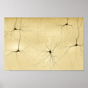 Vintage 1886 Central Nervous System Nerves Poster