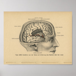 Vintage-1888-Deutscher-Anatomie-Druck Schädel Gehi Poster