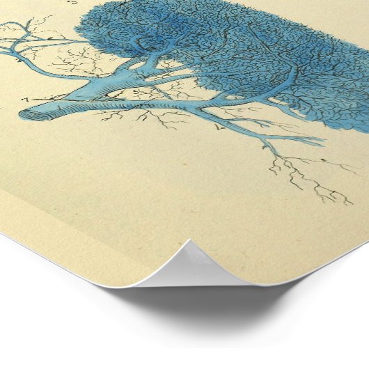 Vintage Anatomie der Leber Poster (Ecke)