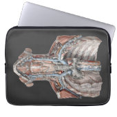 Vintage Anatomie des Menschen Laptopschutzhülle (Vorderseite)