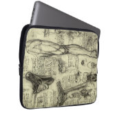 Vintage Anatomie des Menschen Larynx Leg Leonardo Laptopschutzhülle (Vorne Rechts)