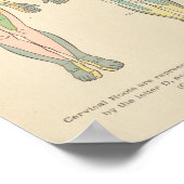 Vintage Anatomie drucken Dermatome Nervenmuster Poster (Ecke)