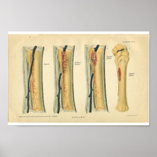 Vintage Anatomie Poster (Vorne)