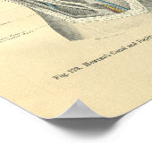 Vintage Anatomie von Knie & Leg Poster (Ecke)