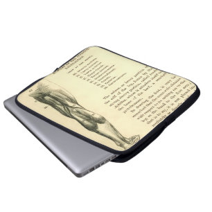 Vintage Bein-Muskeln der Anatomie-  Laptopschutzhülle
