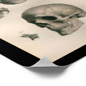 Vintage menschliche Anatomie Druckknochen Poster (Ecke)