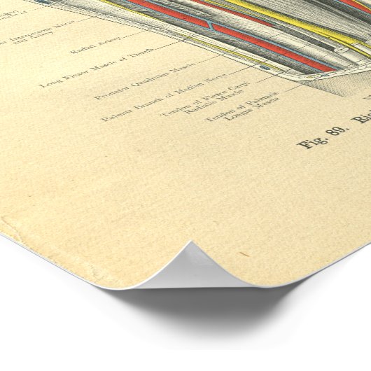 Vintage Morbus Forearm Poster (Ecke)