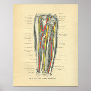 Vintage Morbus Forearm Poster