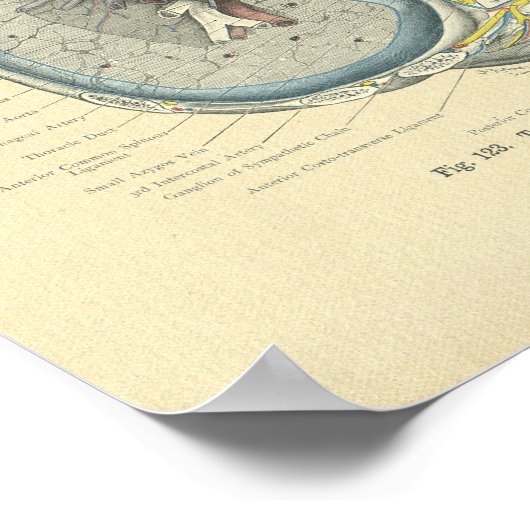 Vintage Morbus Frohse Poster (Ecke)