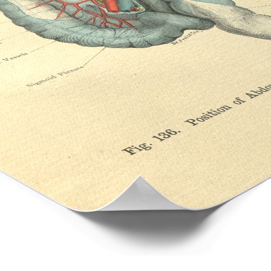 Vintage Morbus Frohse Poster (Ecke)