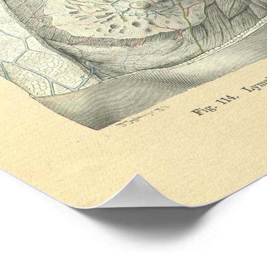 Vintage Morbus Poster (Ecke)