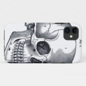 Vintage Schädel-Anatomie Case-Mate iPhone Hülle (Rückseite (Horizontal))