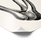 Vintage Skelettarmknochen Personalisierte Retrokno Fotodruck (Ecke)