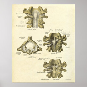 Vintager Anatomie-Druck entbeint zervikalen Dorn Poster