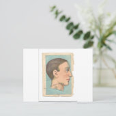 Vintager Anatomie-Foto Postkarte (Stehend Vorderseite)