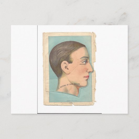 Vintager Anatomie-Foto Postkarte (Vorderseite)