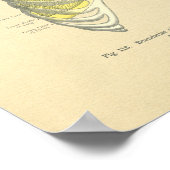 Vintager Frohse Anatomische Lungenspalte Poster (Ecke)