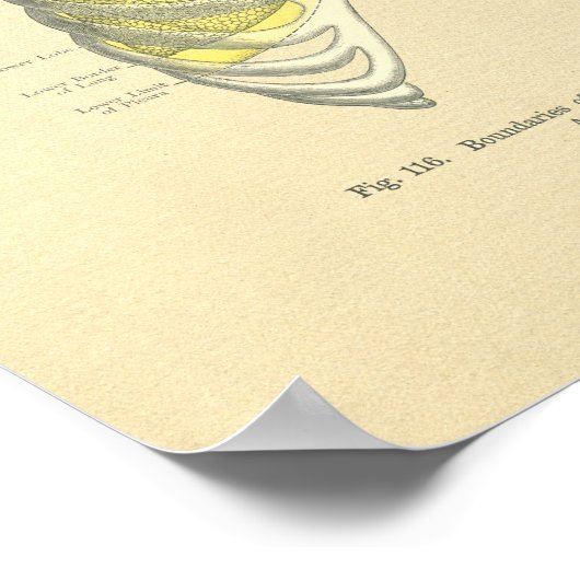 Vintager Frohse Anatomische Lungenspalte Poster (Ecke)