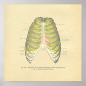 Vintager Frohse Anatomische Lungenspalte Poster (Vorne)