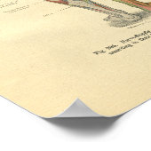 Vintager Frohse Leg Nervenervation drucken Poster (Ecke)