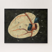 Vintages humanes Herzdiagramm Puzzle (Horizontal)