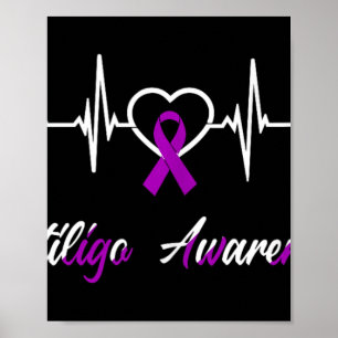 Vitiligo Awareness Heartbeat Liebe Lila Ribbon Su Poster