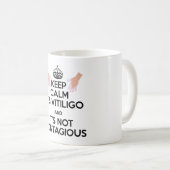 Vitiligo Bewusstseins-tägliche Tasse! Kaffeetasse (VorderseiteRechts)