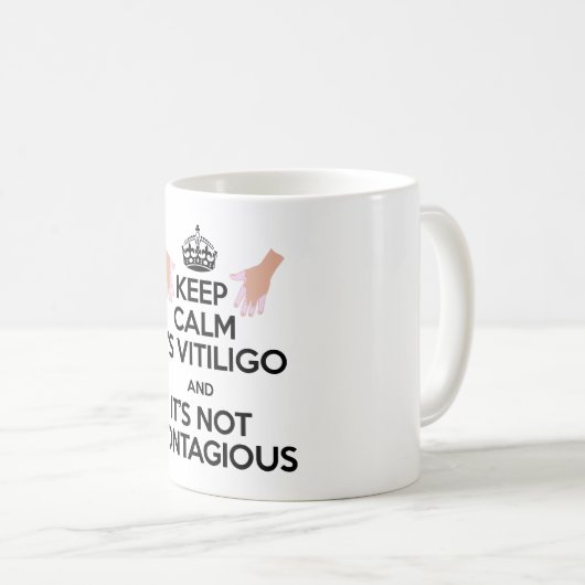 Vitiligo Bewusstseins-tägliche Tasse! Kaffeetasse (VorderseiteRechts)