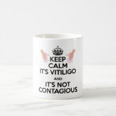 Vitiligo Bewusstseins-tägliche Tasse! Kaffeetasse (Mittel)
