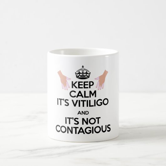 Vitiligo Bewusstseins-tägliche Tasse! Kaffeetasse (Mittel)