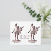 Vor und nach postkarte (Stehend Vorderseite)